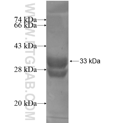 LOC284912 fusion protein Ag13807 SDS-PAGE LOC284912 fusion protein Ag13807 SDS-PAGE