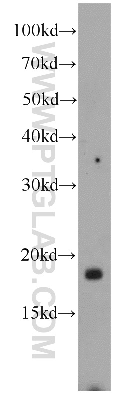 WB analysis of mouse brain using 21958-1-AP