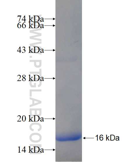LOC286135 fusion protein Ag17433 SDS-PAGE LOC286135 fusion protein Ag17433 SDS-PAGE
