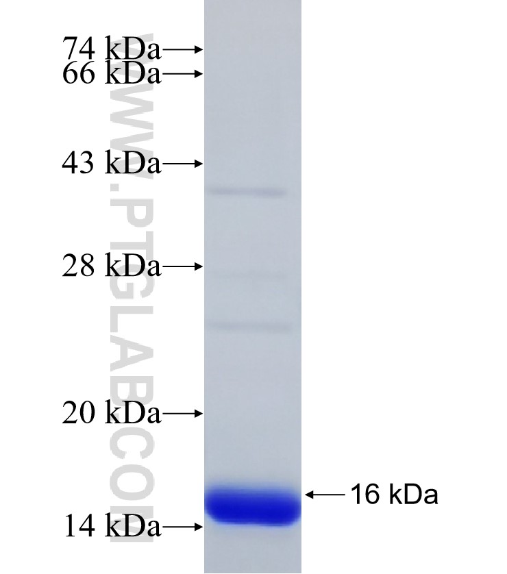 LOC652968 fusion protein Ag30817 SDS-PAGE LOC652968 fusion protein Ag30817 SDS-PAGE