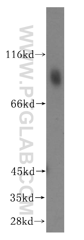 WB analysis of human kidney using 15762-1-AP