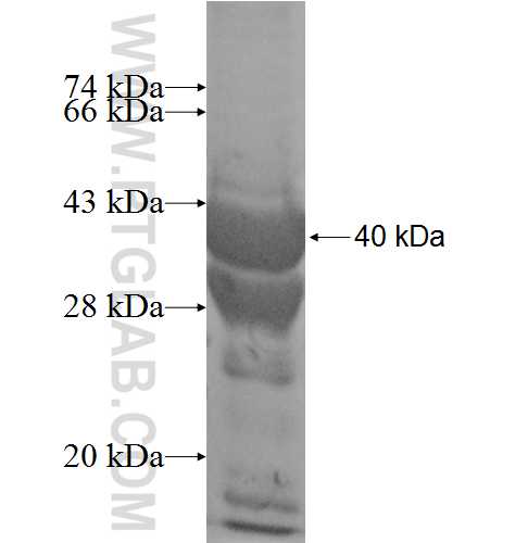 LOC81691 fusion protein Ag8370 SDS-PAGE LOC81691 fusion protein Ag8370 SDS-PAGE