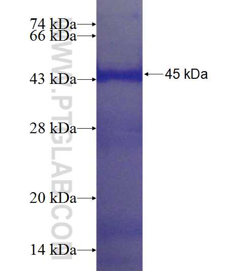 LOC90826 fusion protein Ag23499 SDS-PAGE LOC90826 fusion protein Ag23499 SDS-PAGE