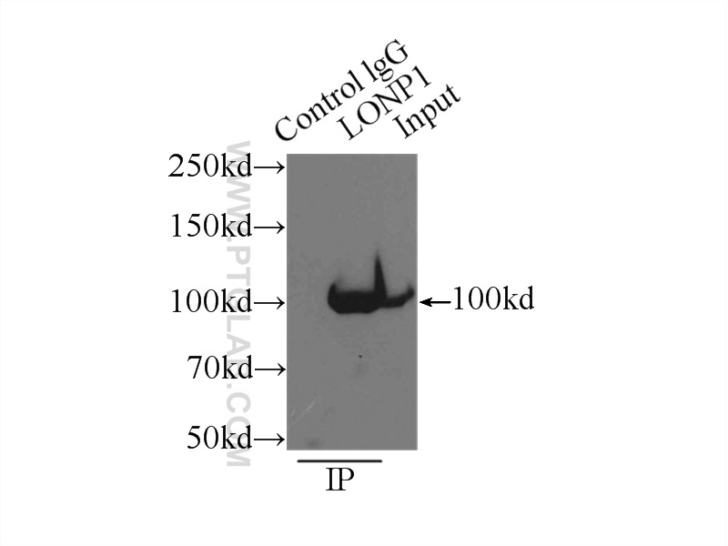 IP experiment of mouse heart using 15440-1-AP