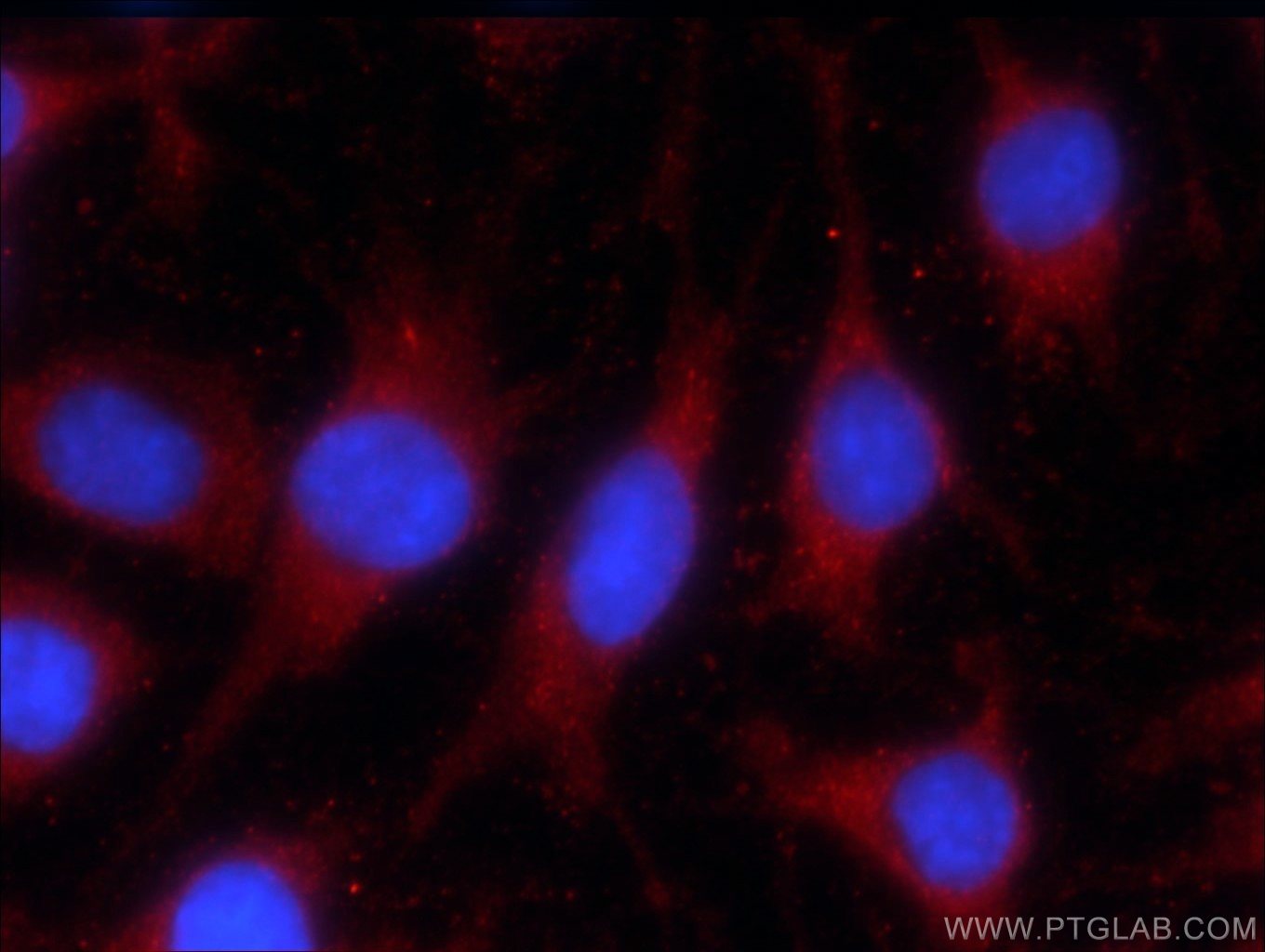 LONP1 Monoclonal antibody