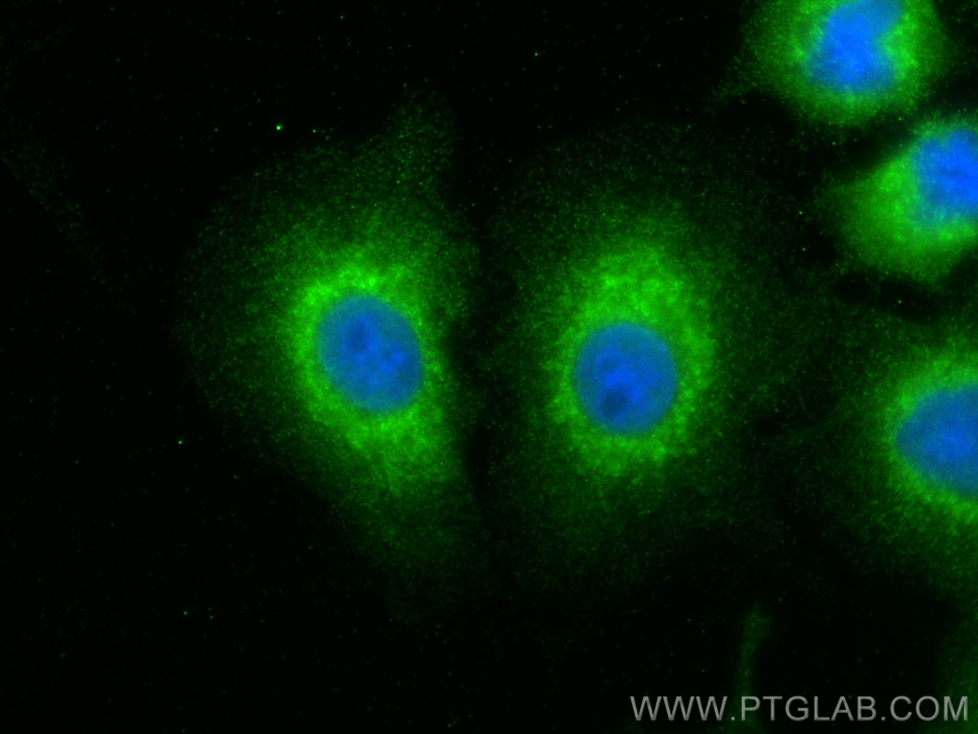 IF Staining of A549 using 18035-1-AP