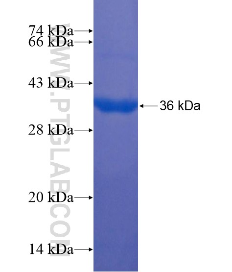 LONRF2 fusion protein Ag22089 SDS-PAGE LONRF2 fusion protein Ag22089 SDS-PAGE