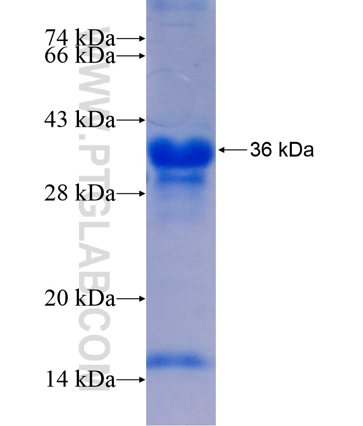 LONRF3 fusion protein Ag17478 SDS-PAGE LONRF3 fusion protein Ag17478 SDS-PAGE