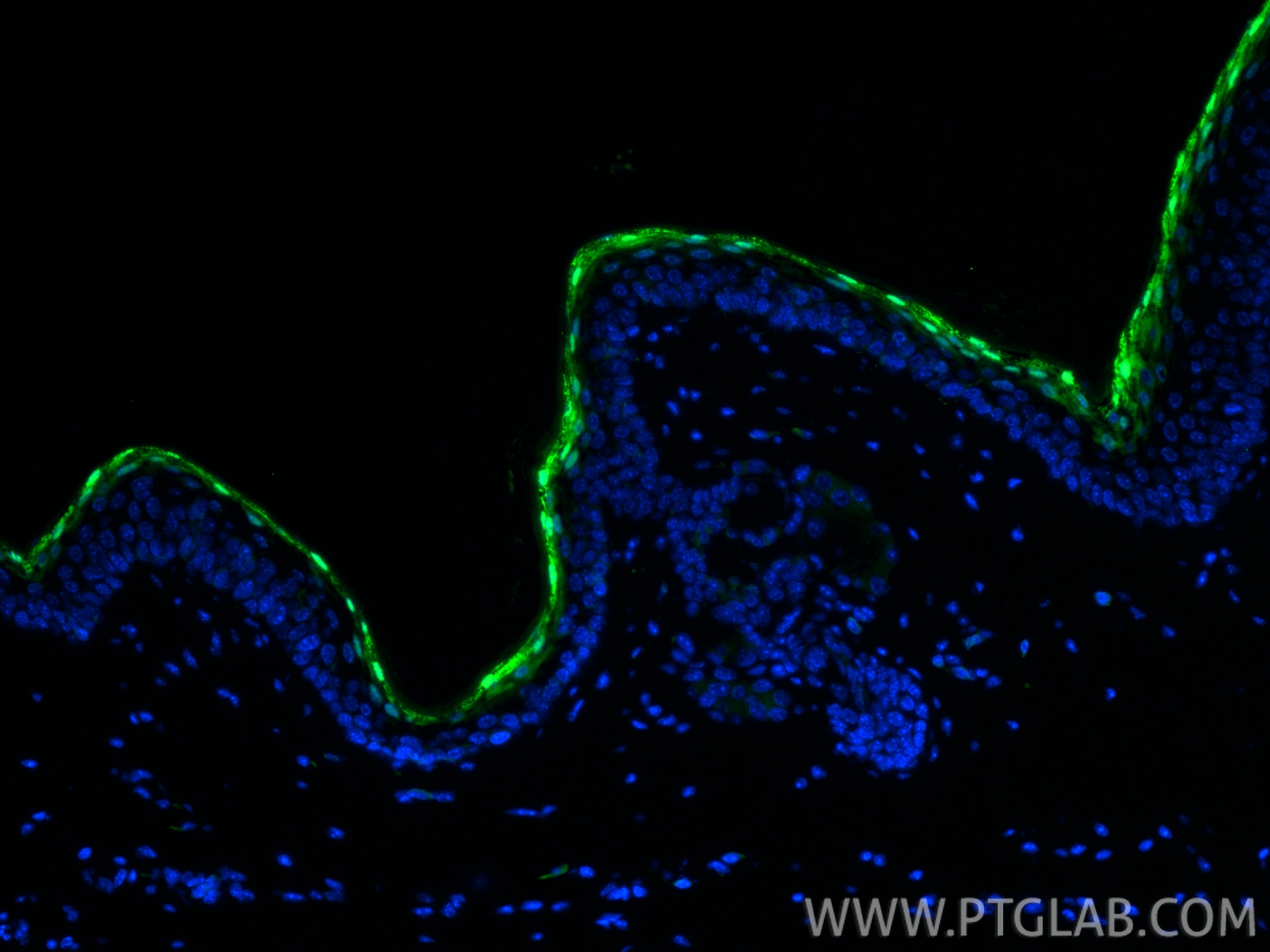 IF Staining of mouse skin using 55439-1-AP (same clone as 55439-1-PBS)