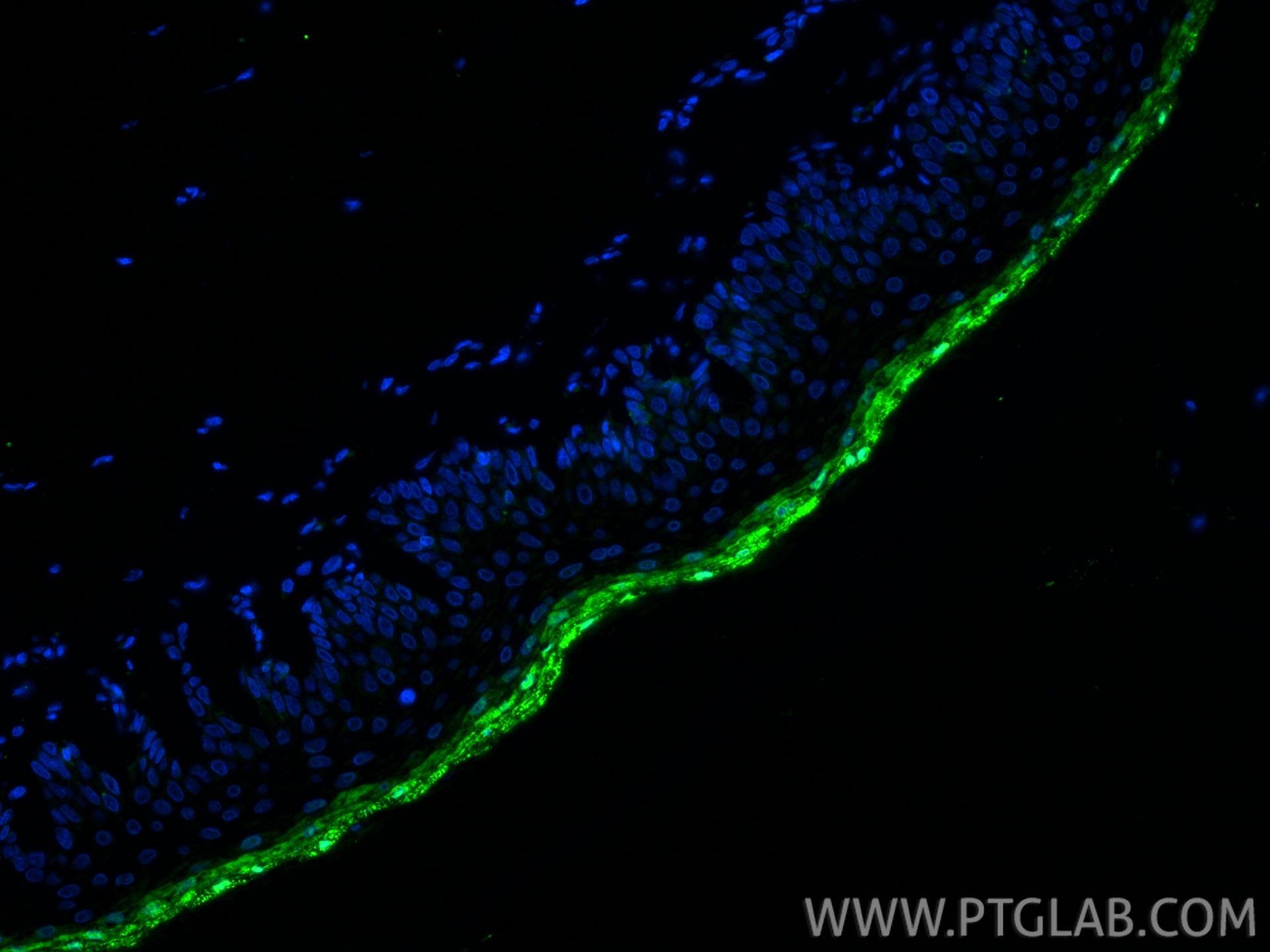 IF Staining of rat skin using 55439-1-AP (same clone as 55439-1-PBS)