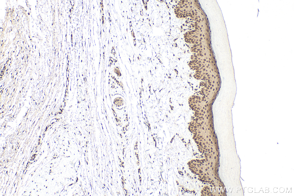 IHC staining of rat skin using 55439-1-AP