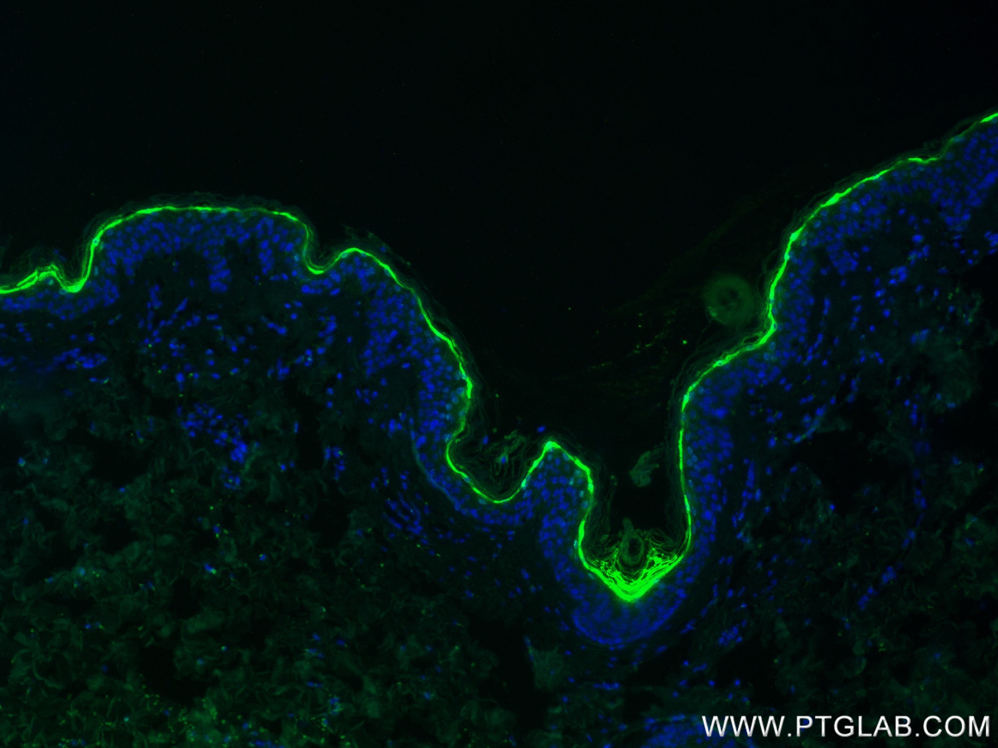 IF Staining of human skin using 83865-2-RR (same clone as 83865-2-PBS) IF Staining of human skin using 83865-2-RR (same clone as 83865-2-PBS)