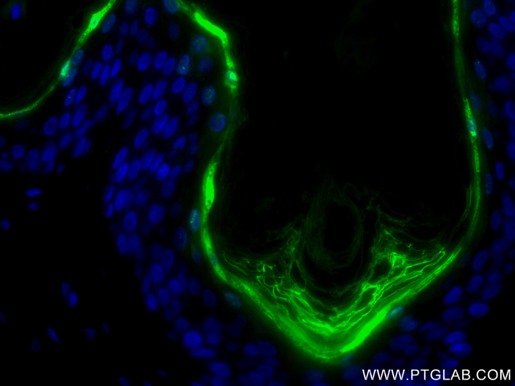 IF Staining of human skin using 83865-2-RR (same clone as 83865-2-PBS) IF Staining of human skin using 83865-2-RR (same clone as 83865-2-PBS)