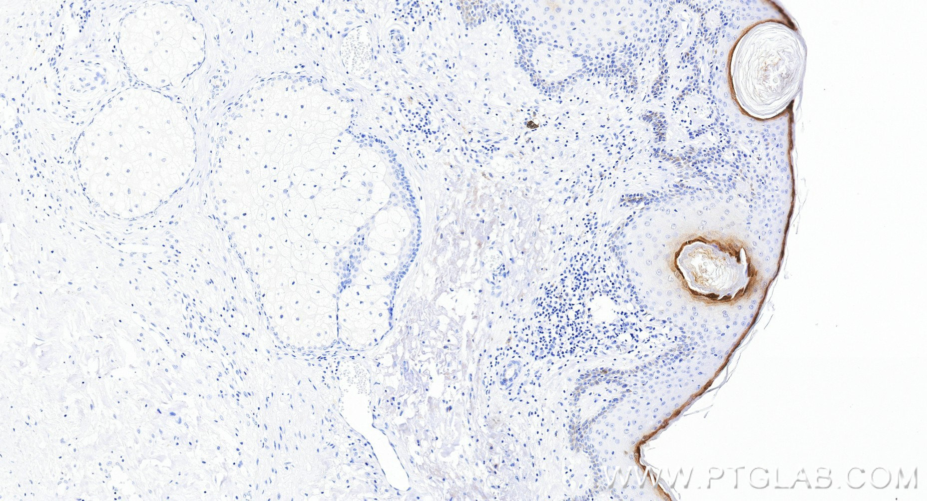 IHC staining of human skin using 83865-2-RR (same clone as 83865-2-PBS) IHC staining of human skin using 83865-2-RR (same clone as 83865-2-PBS)