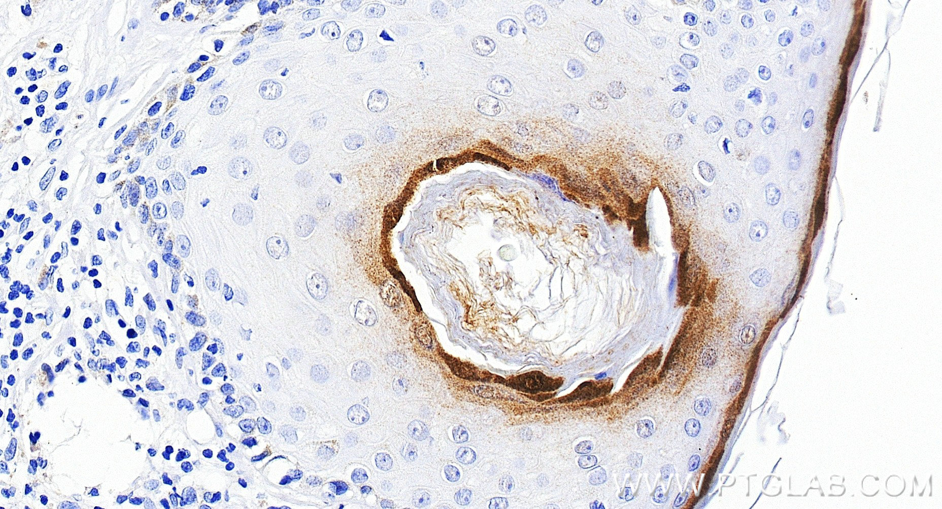 IHC staining of human skin using 83865-2-RR (same clone as 83865-2-PBS) IHC staining of human skin using 83865-2-RR (same clone as 83865-2-PBS)