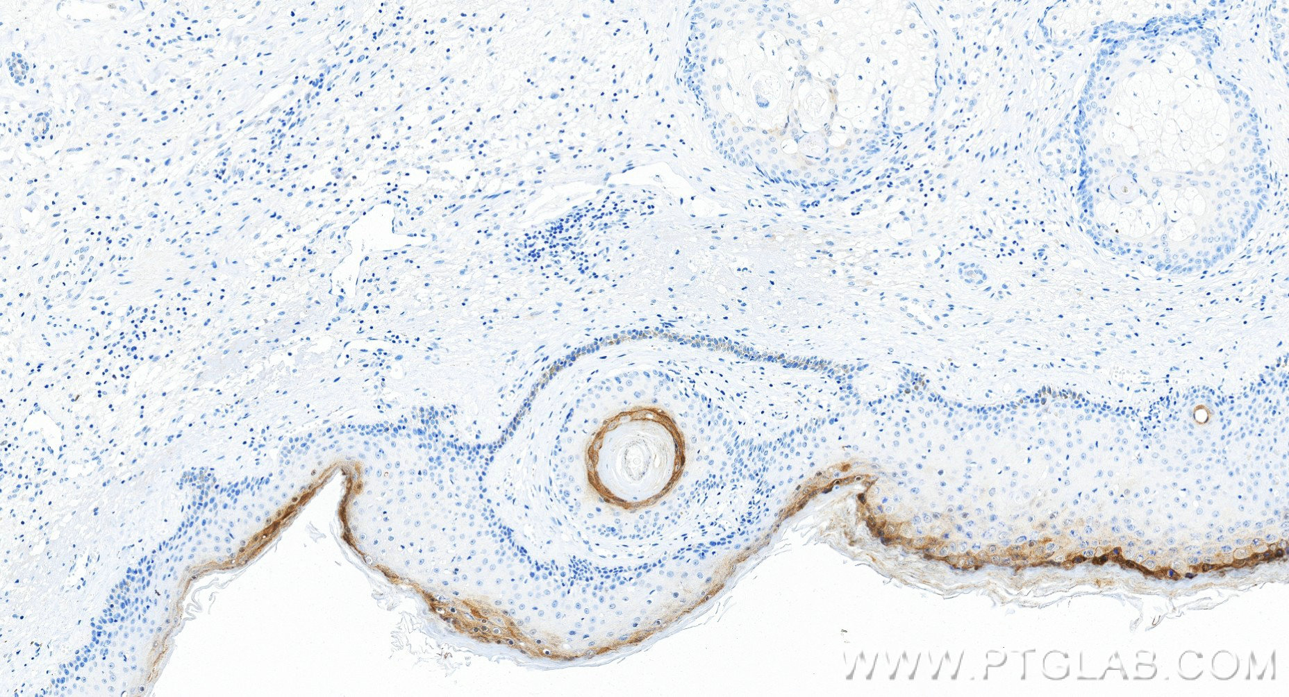IHC staining of human skin using 83865-2-RR (same clone as 83865-2-PBS)