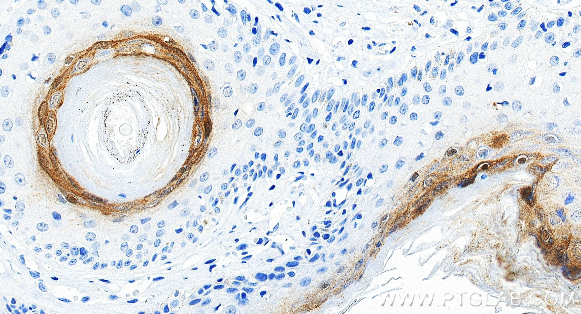 IHC staining of human skin using 83865-2-RR (same clone as 83865-2-PBS)