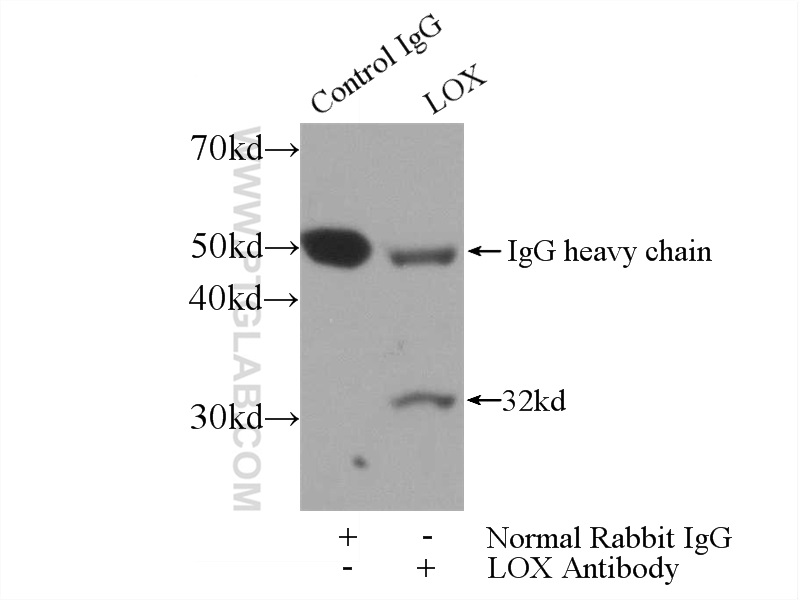 IP experiment of mouse skeletal muscle using 17958-1-AP