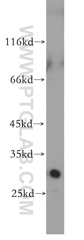 WB analysis of Jurkat using 17958-1-AP