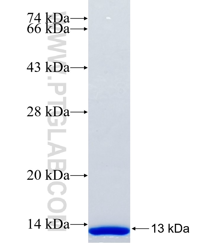 LOX fusion protein Ag31358 SDS-PAGE LOX fusion protein Ag31358 SDS-PAGE