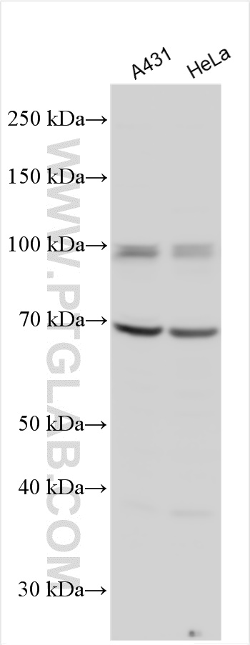 WB analysis using 15232-1-AP