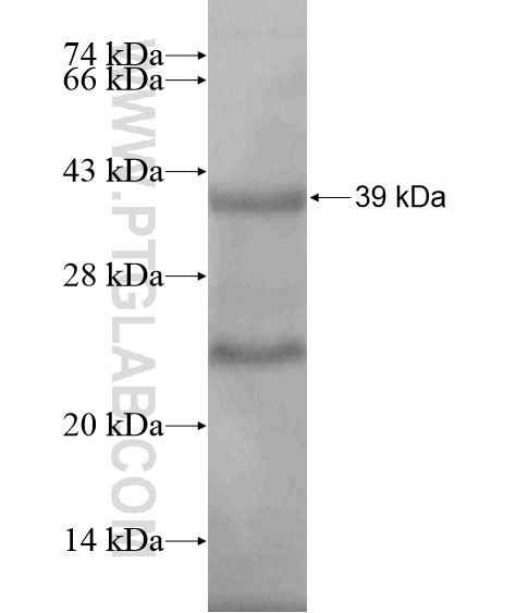 LOXL4 fusion protein Ag20306 SDS-PAGE LOXL4 fusion protein Ag20306 SDS-PAGE