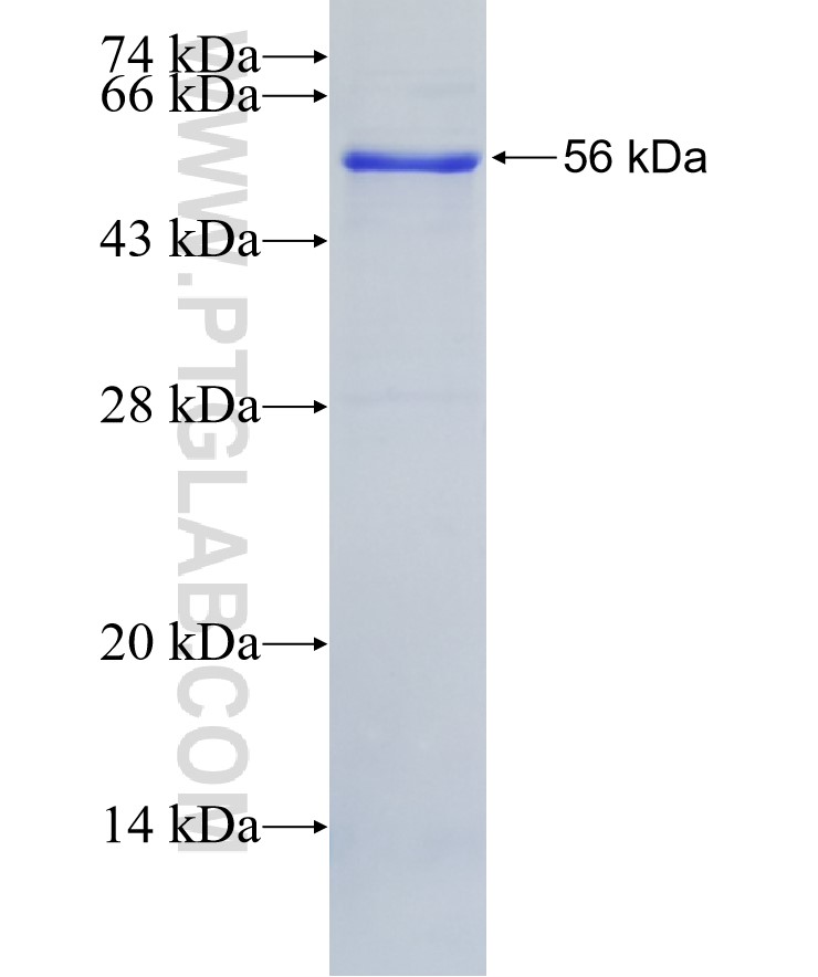 LOXL4 fusion protein Ag2669 SDS-PAGE LOXL4 fusion protein Ag2669 SDS-PAGE