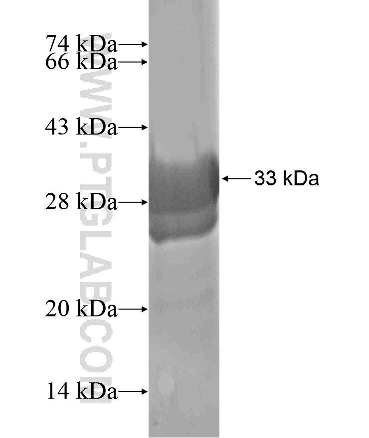 LPAR3 fusion protein Ag17925 SDS-PAGE LPAR3 fusion protein Ag17925 SDS-PAGE