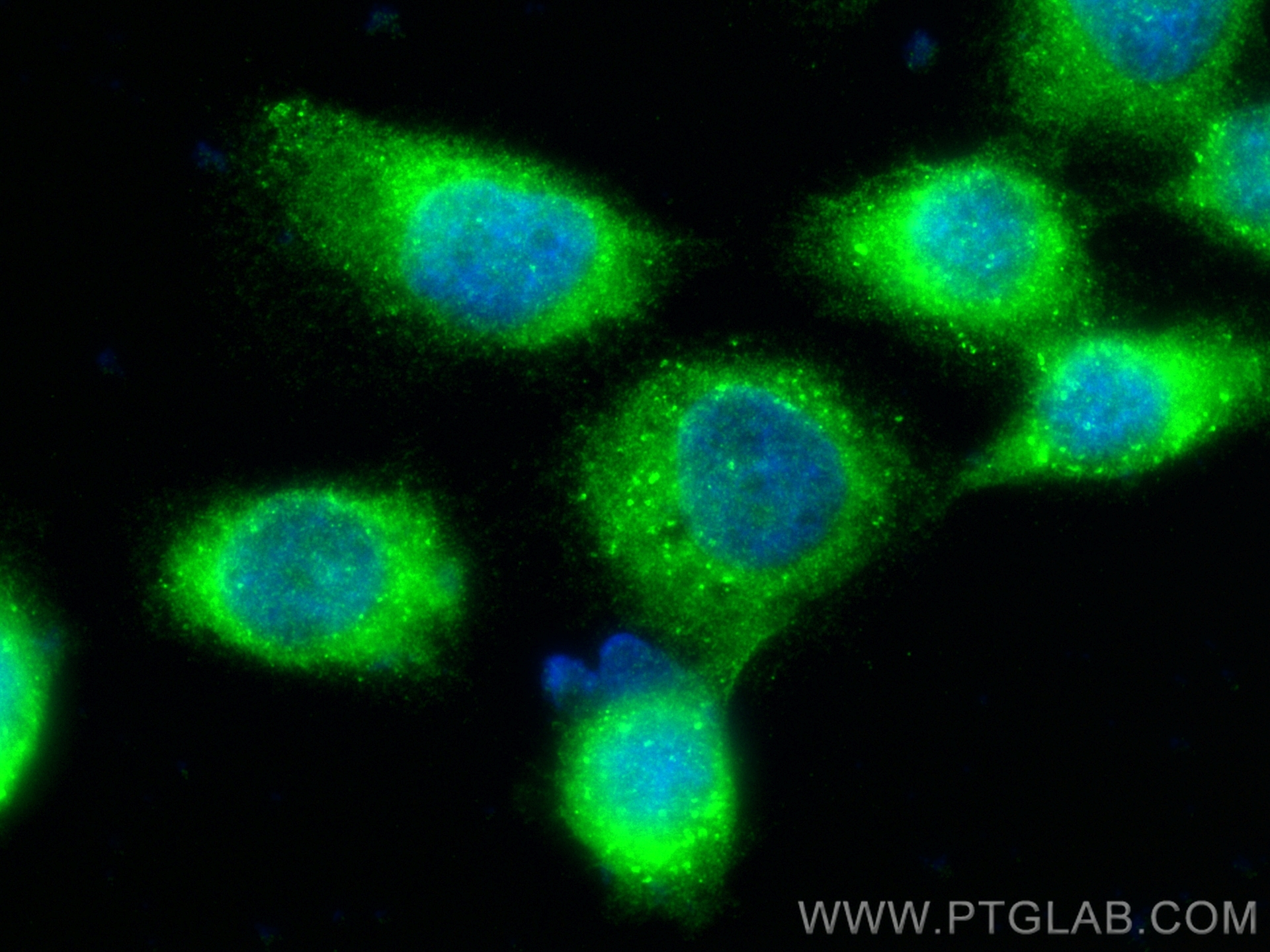 IF Staining of A431 using 16112-1-AP