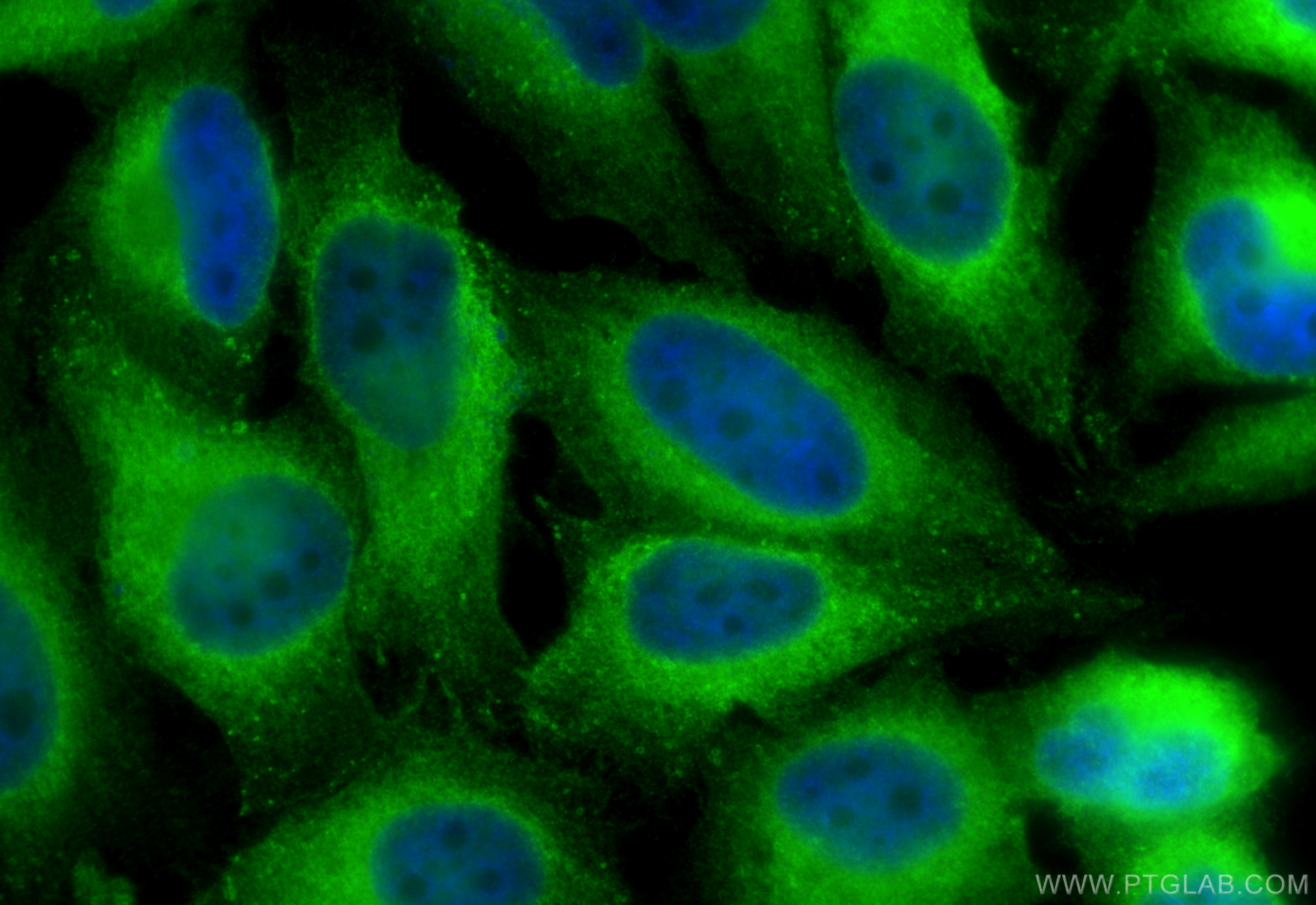 IF Staining of HeLa using 16112-1-AP