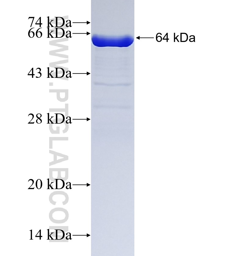 LPCAT1 fusion protein Ag9035 SDS-PAGE