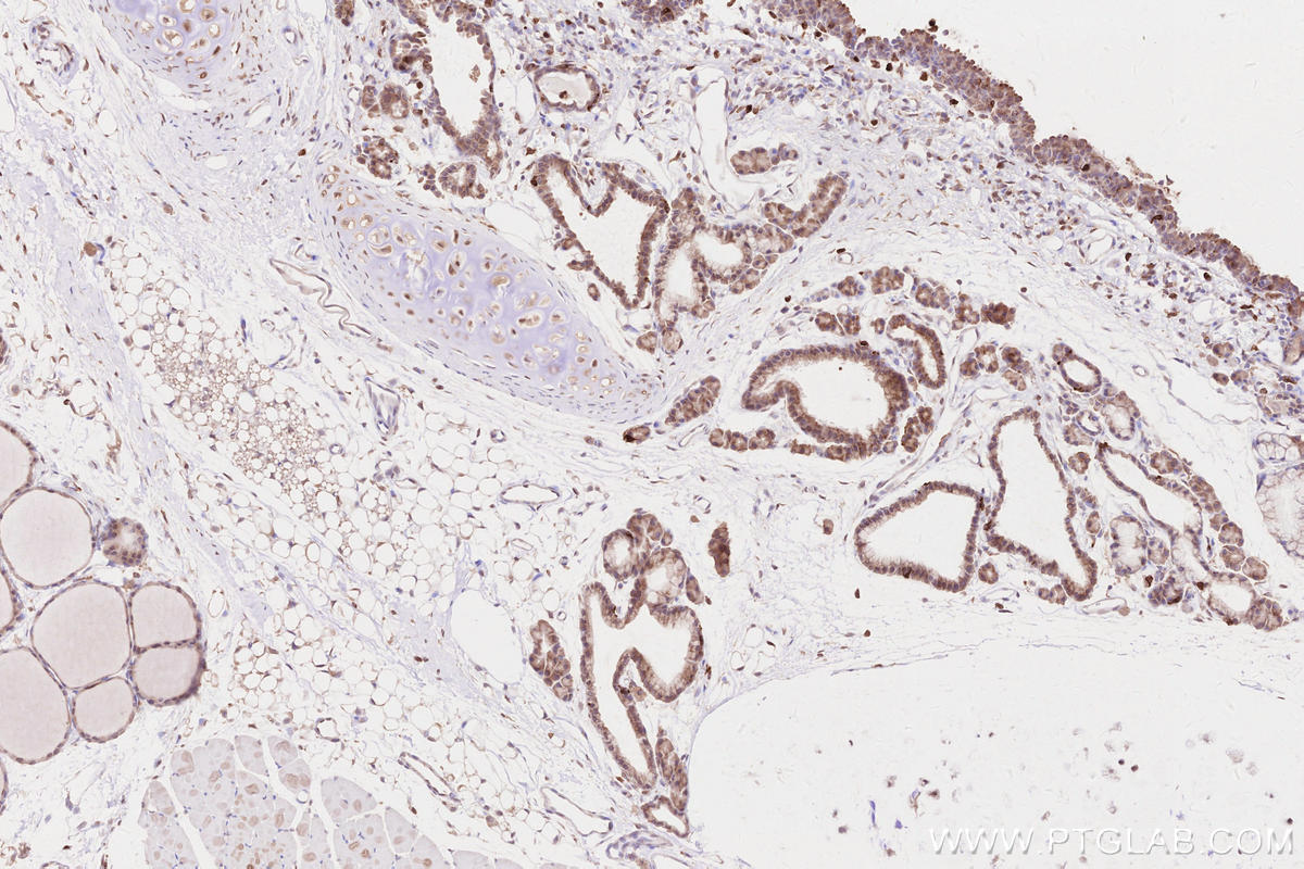IHC staining of rat thyroid gland using 15082-1-AP