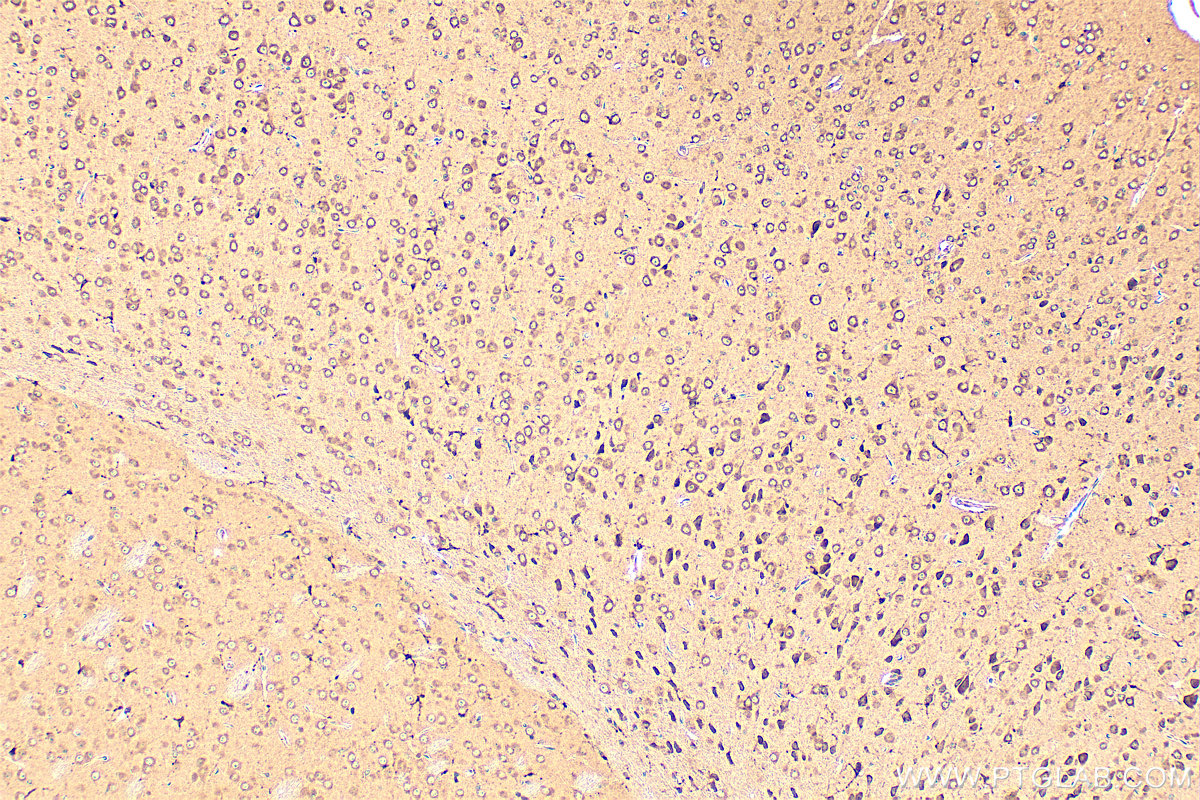 IHC staining of mouse brain using 15082-1-AP