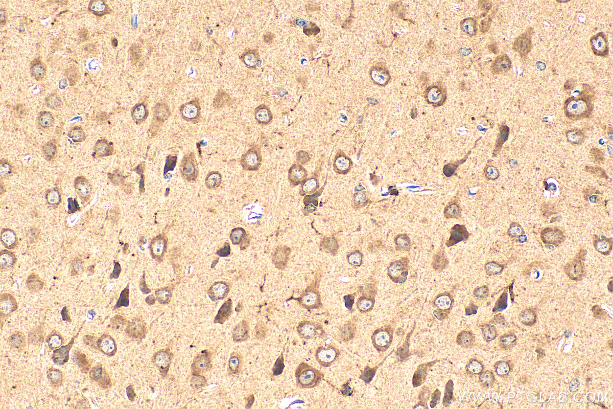 IHC staining of mouse brain using 15082-1-AP
