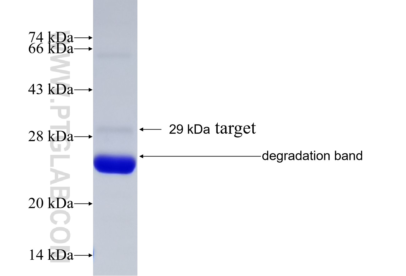 LPCAT2 fusion protein Ag26420 SDS-PAGE