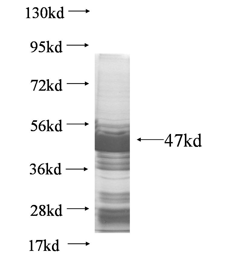 LPCAT2 fusion protein Ag7079 SDS-PAGE