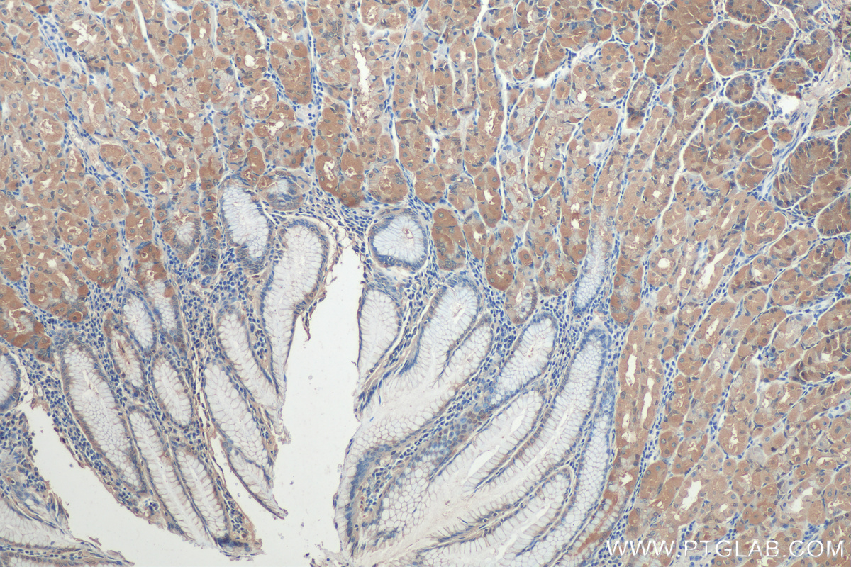 IHC staining of human stomach using 67882-1-Ig