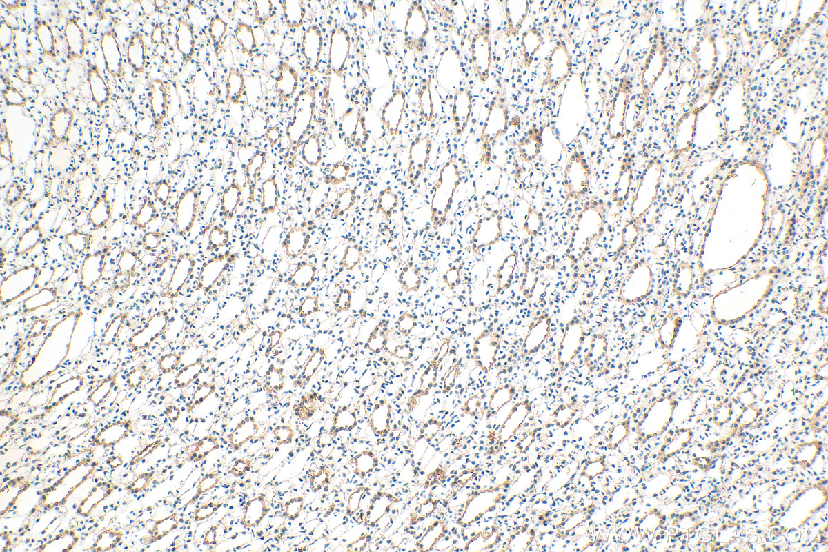 IHC staining of rat kidney using 30142-1-AP