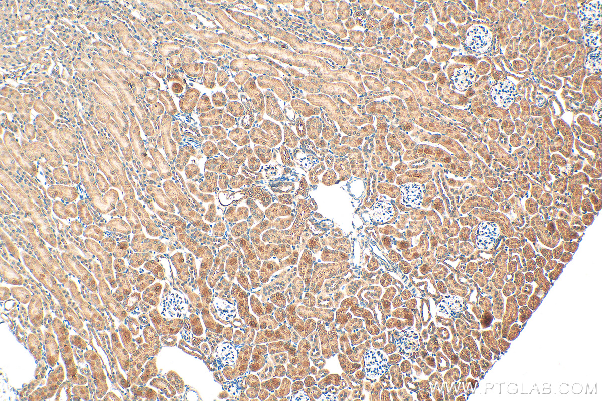 IHC staining of mouse kidney using 30142-1-AP