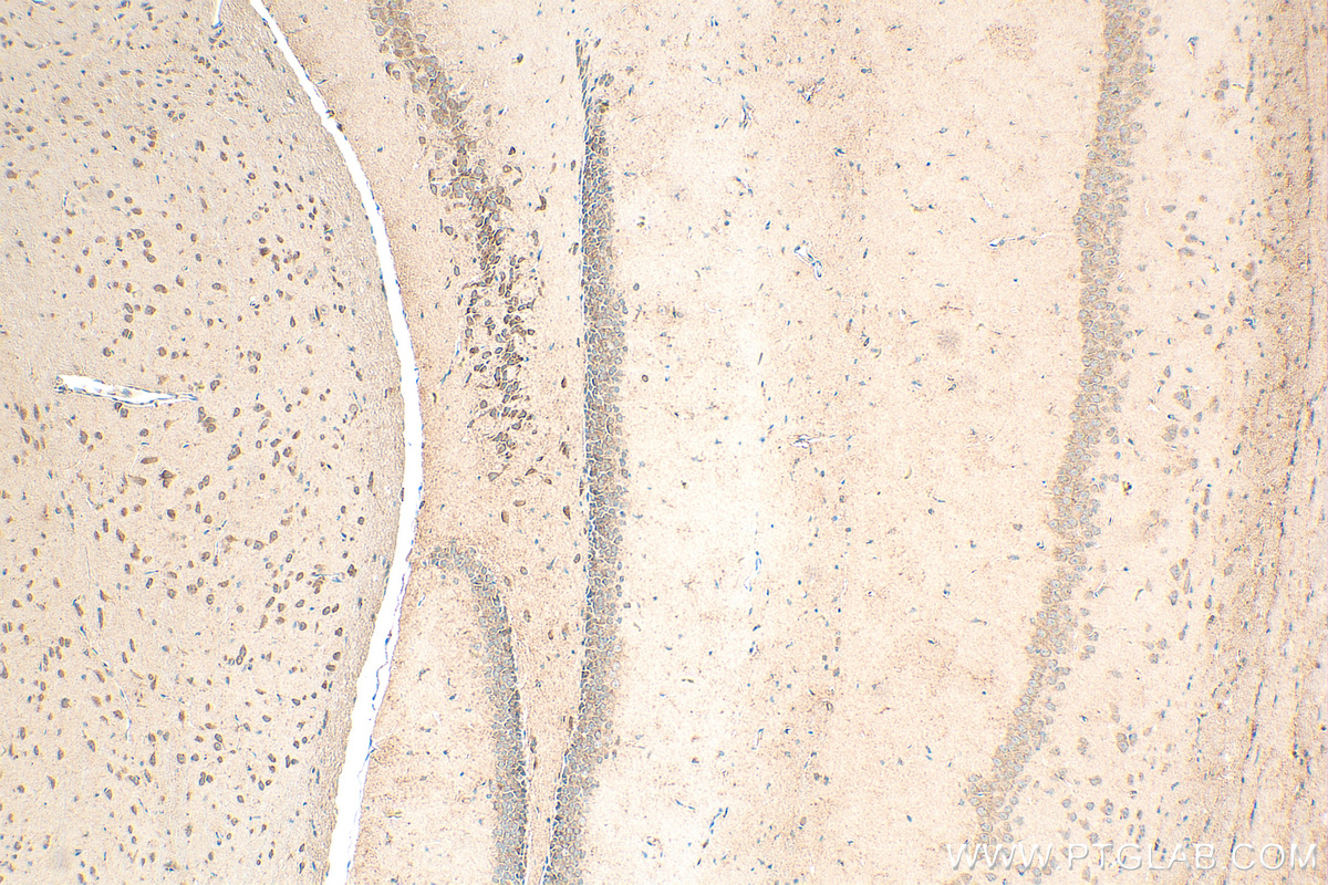 IHC staining of mouse brain using 30142-1-AP