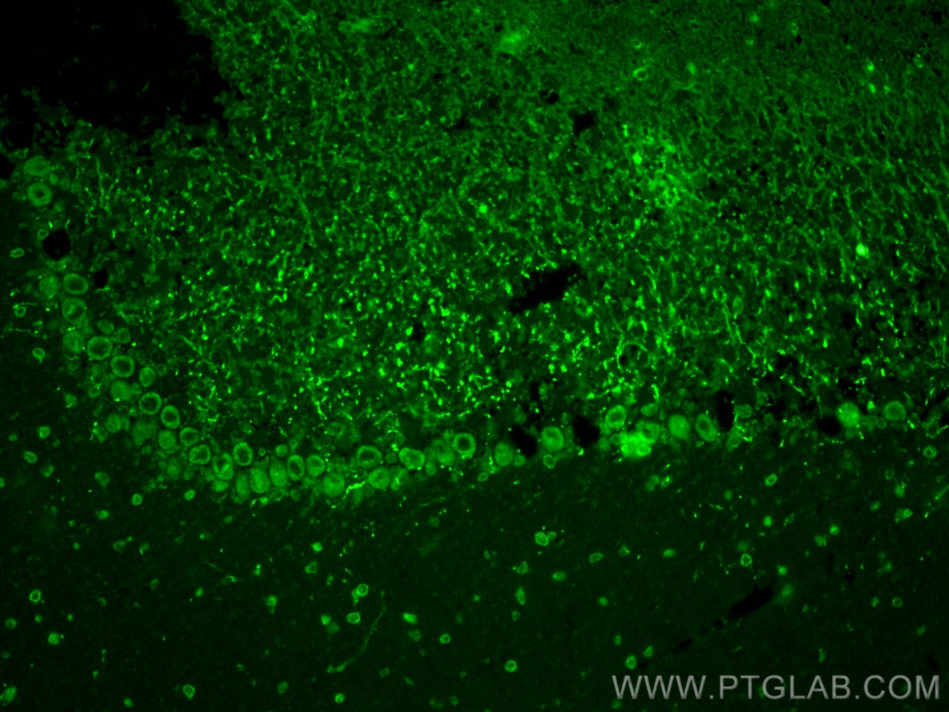 IF Staining of mouse cerebellum using 20043-1-AP
