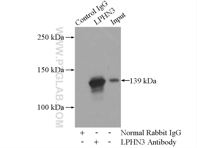 IP experiment of mouse brain using 20045-1-AP