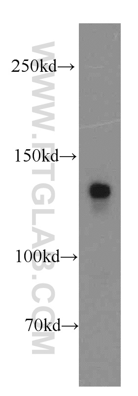 WB analysis of mouse brain using 20045-1-AP