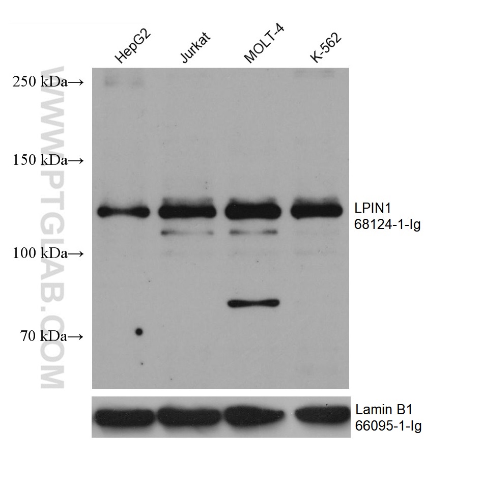 WB analysis using 68124-1-Ig