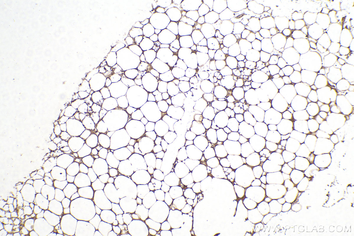 IHC staining of mouse brown adipose using 28602-1-AP (same clone as 28602-1-PBS)