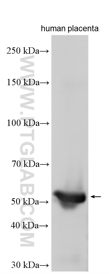 WB analysis of human placenta using 28602-1-AP WB analysis of human placenta using 28602-1-AP