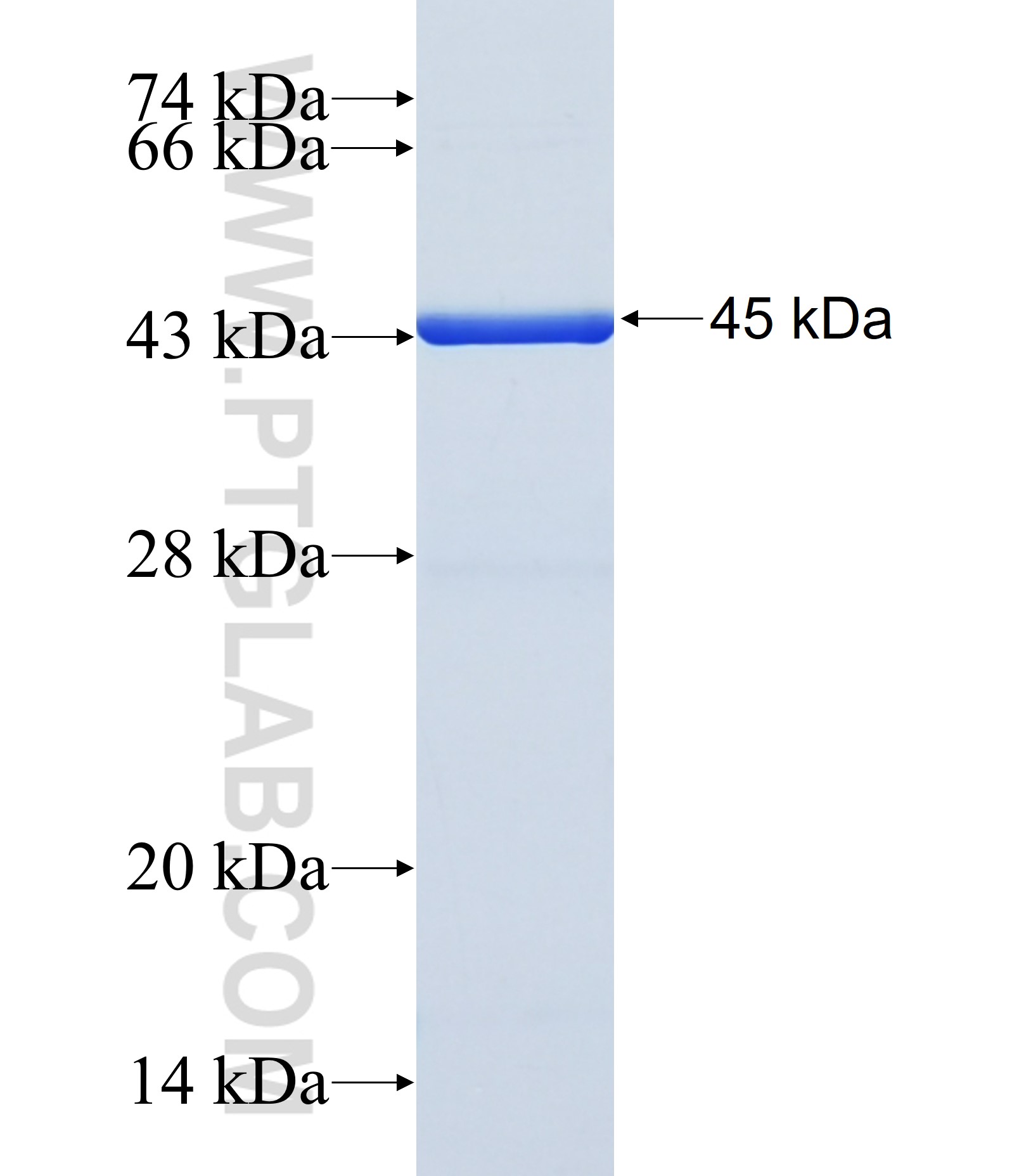 LPL fusion protein Ag29782 SDS-PAGE