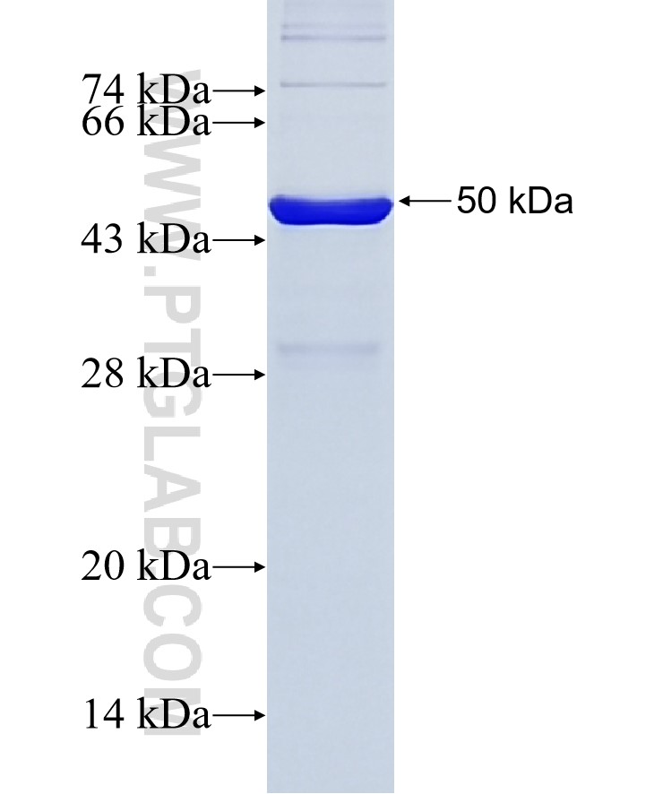 LPL fusion protein Ag10450 SDS-PAGE