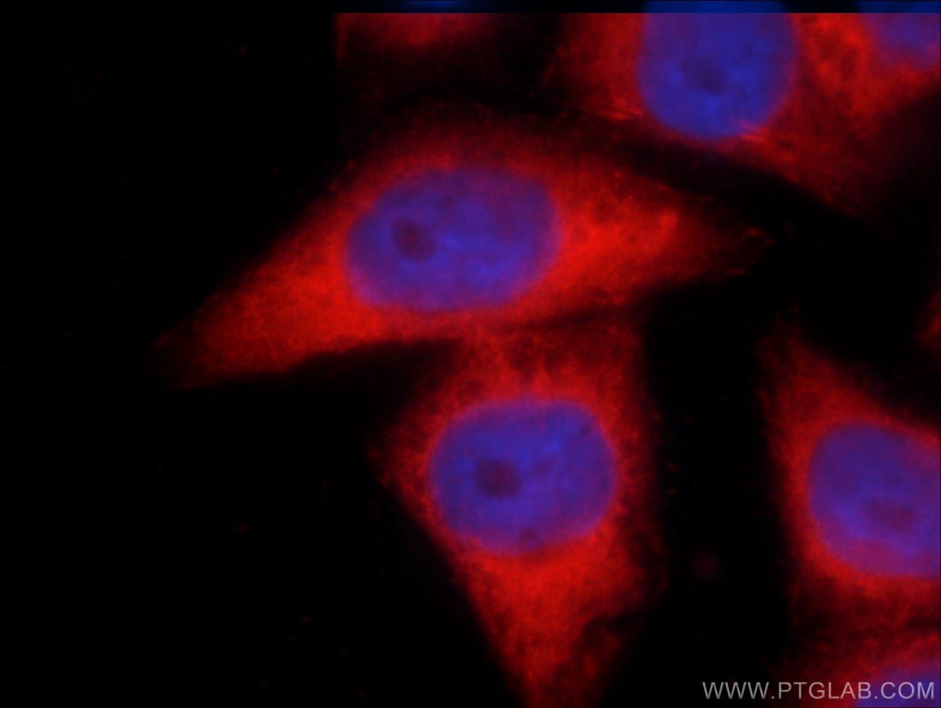 IF Staining of HeLa using 25045-1-AP