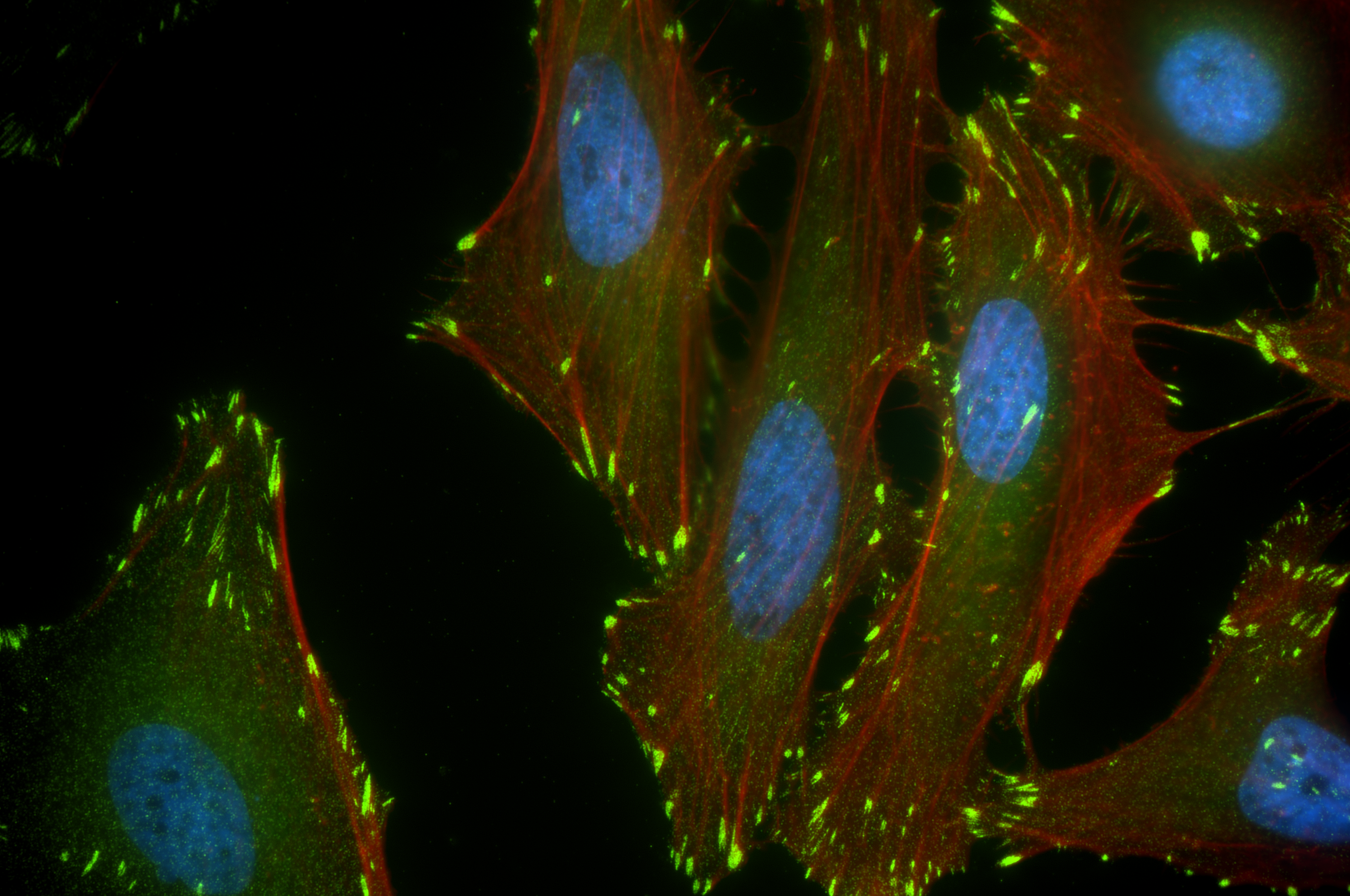 IF Staining of HeLa using 86117-3-RR (same clone as 86117-3-PBS)